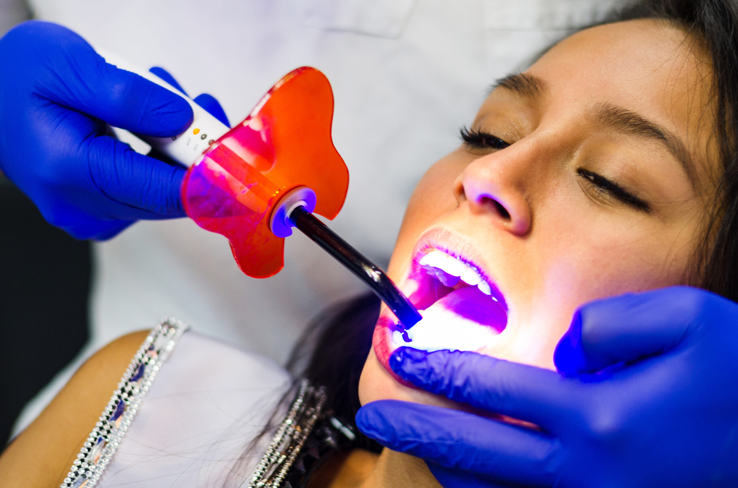 Benefits of Laser Dentistry