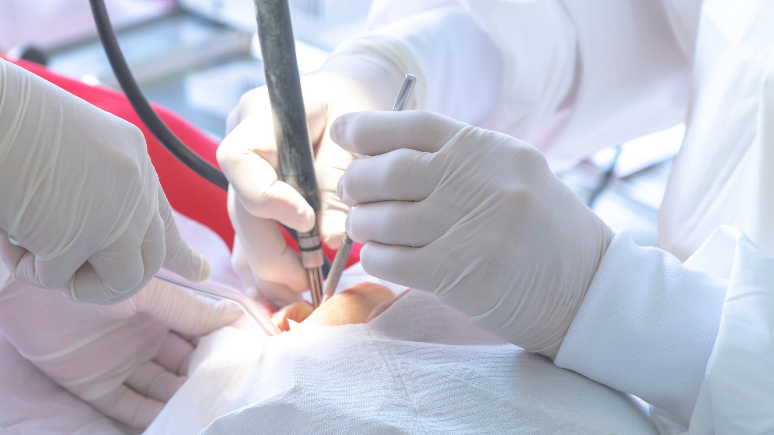 How Dental Sealants Are Applied