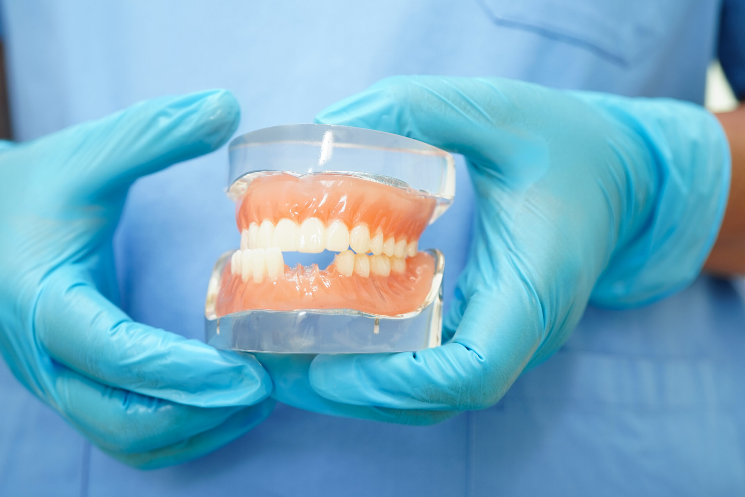 What Are Dentures